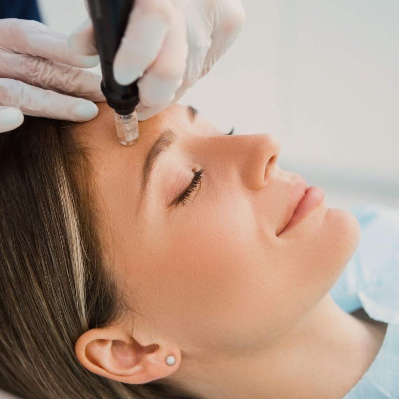 Medical Beauty, Needling und apparative Hautverbesserung